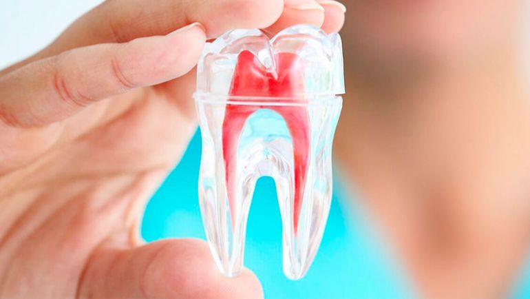 Endodoncia